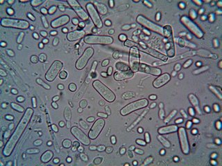 Climate Change Fueling Growth of Antibiotic-Resistant Salmonella
