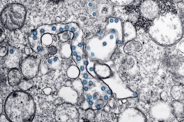 New Virus Mix May Help Fight Super Germs