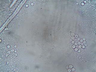Scientists discover how cells change shape on their own