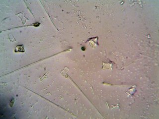 Scientists Find Strange Matter at Earth's Center